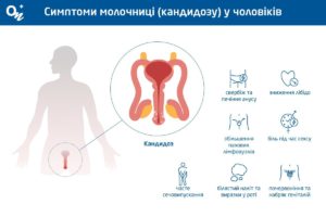 Головні причини виникнення кандидозу в організмі